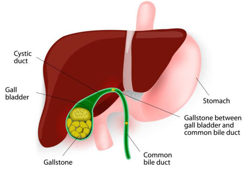 The gallbladder is a pear shaped organ present beneath the liver